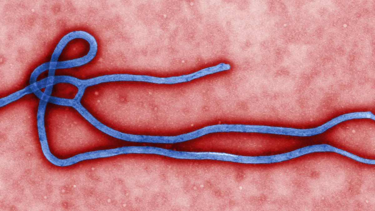 Archive electron micrograph of Ebola virus; not the Nigerian patient or necessarily the Bundibugyo variant
